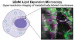 Lipid Expansion Microscopy